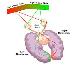 contralateral