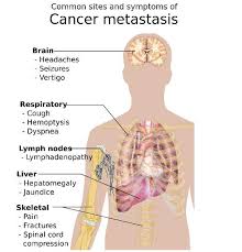 metastasise