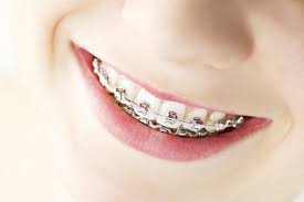 orthodontia